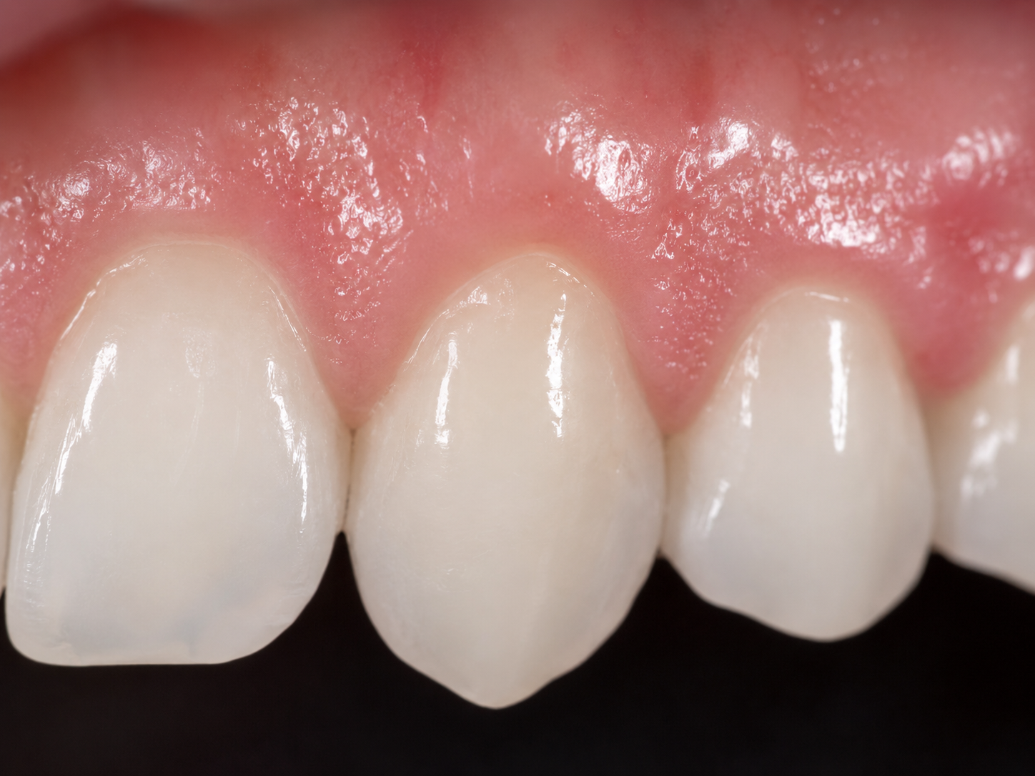 Periodoncia